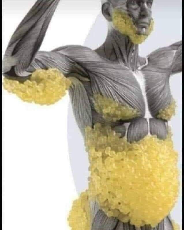 الكرش