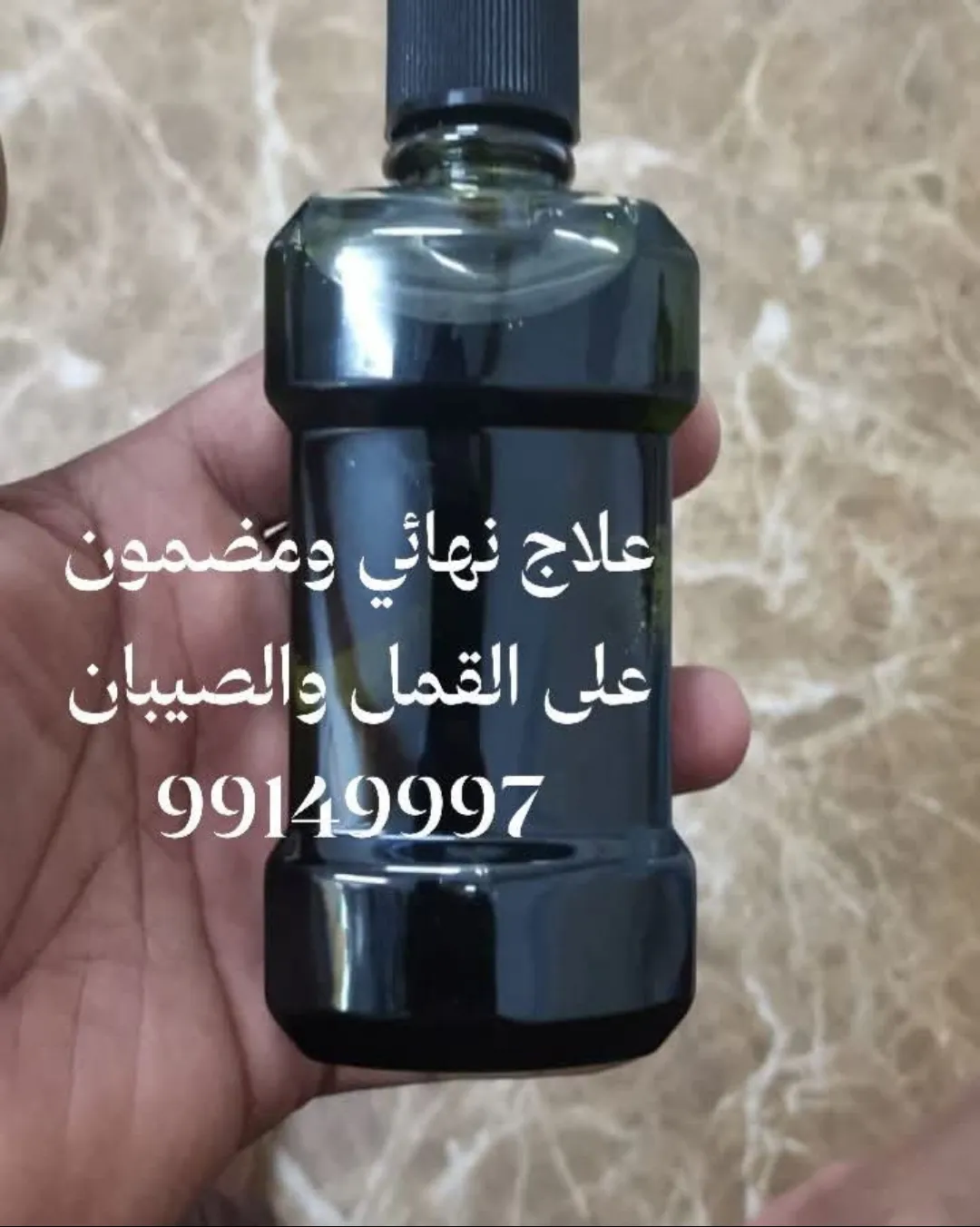 مستحضر عشبي يقضي على القمل والصيبان نهائياً