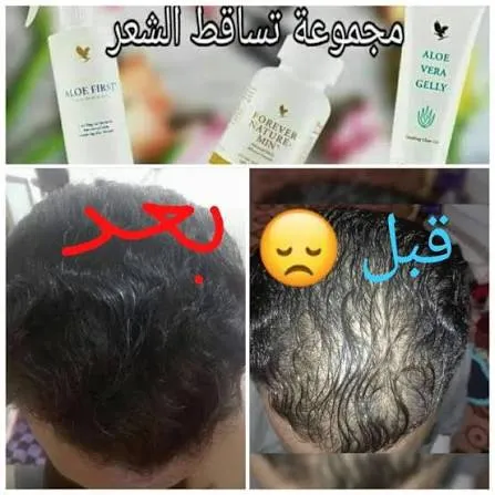 مجموعة العناية بالشعر